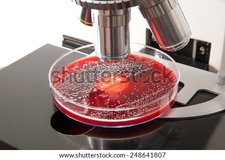 Petri dish with Escherichia Colli bacteria under the light of the laboratory microscope. Medical laboratory concept