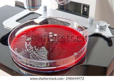 Bacteria colonies on petri dish under the light of the microscope. Close up of Staphylococcus aureus bacteria