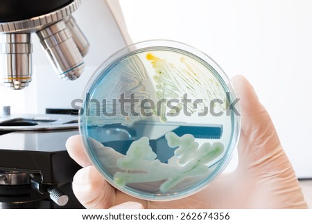Laboratory doctor hand holding petri dish infected with different bacteria. Cled agar petri dish and laboratory microscope in the background