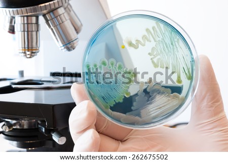 Petri dish infected with different bacteria in laboratory doctor hand. Cled agar petri dish and laboratory microscope in the background