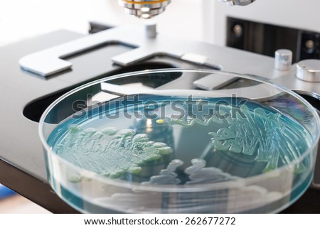 Petri dish and laboratory microscope. Cled agar petri dish infected with different bacteria. Medical laboratory concept