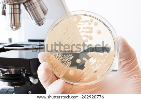 Laboratory doctor hand with gloves holding petri dish with bacteria. Laboratory microscope in the background