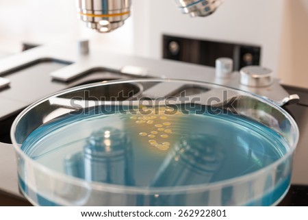 Petri dish with bacteria on laboratory microscope. Escherichia Colli bacteria on petri dish