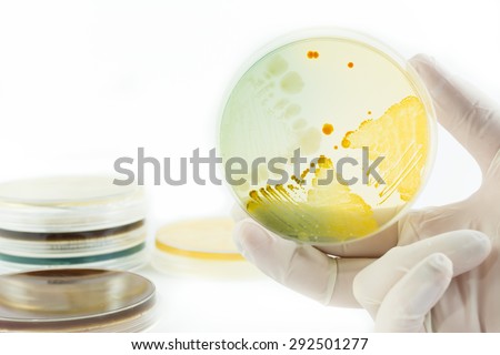 Hand in glove holding petri dish with bacteria growing on it isolated on white background. Medical tests and research. Bacterial cultures in laboratory glassware
