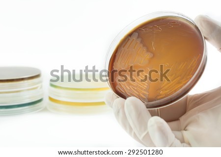 Hand in glove holding petri dish with bacteria growing on it isolated on white background. Medical tests and research. Bacterial cultures in laboratory glassware
