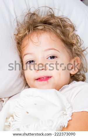 Little girl with cold sores