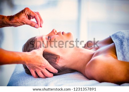 Woman receiving acupuncture treatment at spa