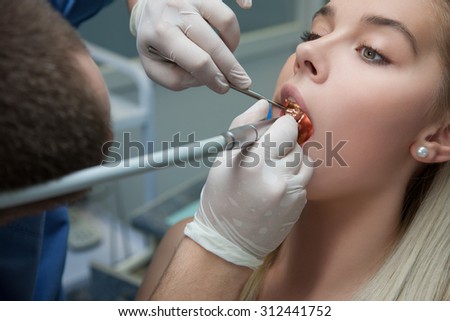 People, medicine,  and health care concept -  drill and dental air water gun spray treating female patient teeth at dental clinic. Woman changing the seal in the doctor's office.inspection of teeth