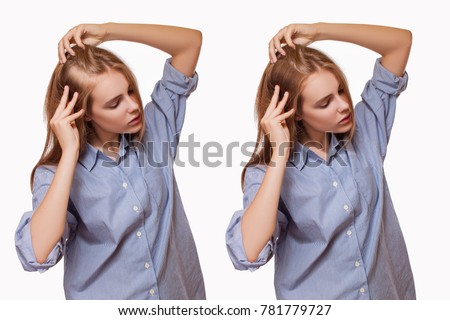 Woman Before and After Hair Loss Treatment on White Background
