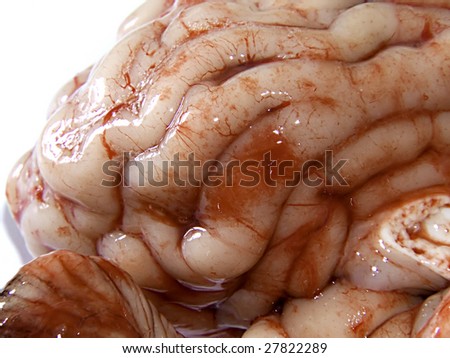 Real Brain Pics