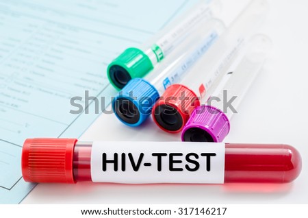 Blood sample for HIV test and empty tube blood for blood test screening with blank label on request form screening test.