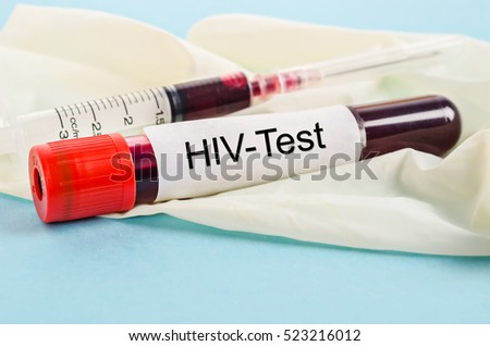 Sample blood for screening test for HIV test and syringe on glove in laboratory.