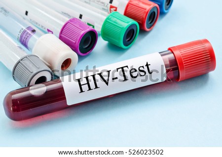 Sample blood collection tube with HIV test label in laboratory.