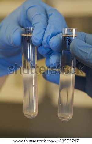 Protein Bands in Test Tubes