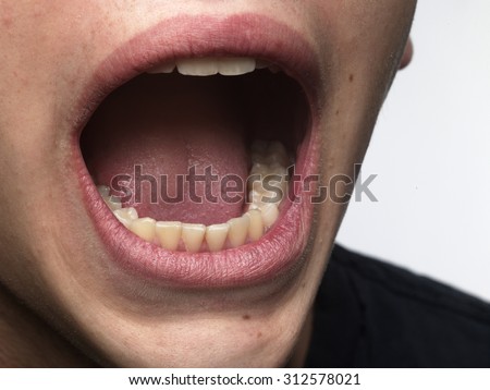 Open Mouth