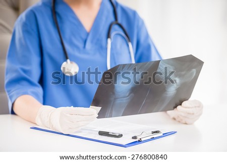 Closeup of female doctor  in rubber gloves with stethoscope looking at X-ray at doctor\'s office.