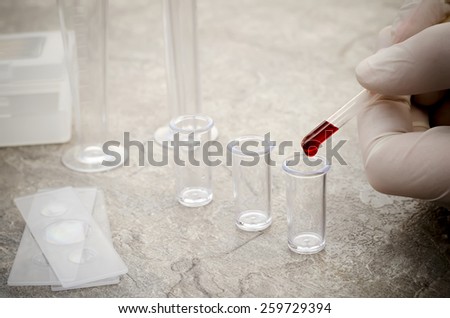 Test tubes with blood in laboratory