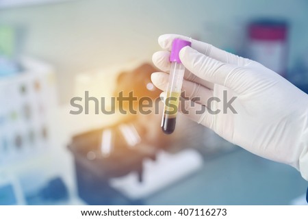 blood in tube laboratory