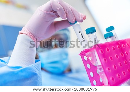 Medical professionals in the laboratory with smears and saliva samples for Covid-19 and Coronavirus tests