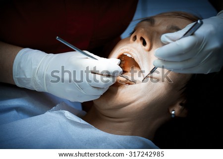 Dentist examining a patients teeth before oral surgery at the dental clinic. Removing amalgam fillings. Professional care of patient teeth.