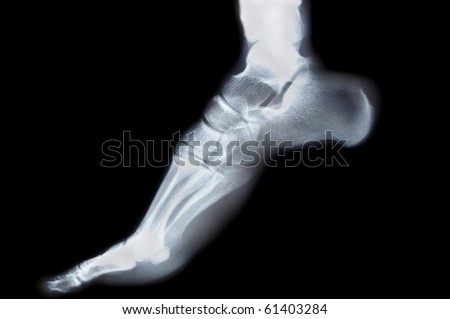 human foot ankel and leg xray picture