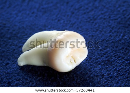 Removed wisdom tooth on a blue background