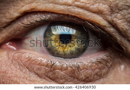 The eye of an old man