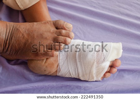 White medicine bandage on human  foot