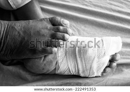 White medicine bandage on human  foot