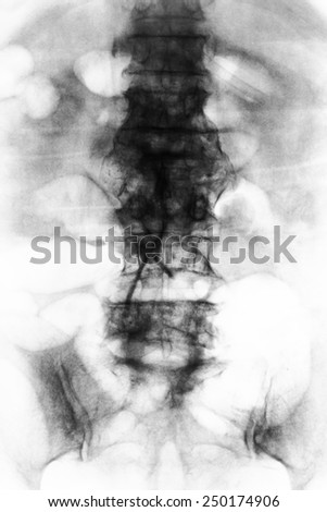 X -ray of spine and pelvis / Many others X-ray images in my portfolio.