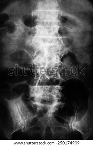 X -ray of spine and pelvis / Many others X-ray images in my portfolio.