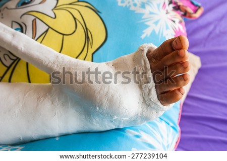 leg in a plaster cast