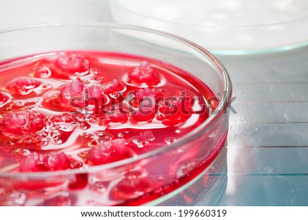 Petri dish with various bacteria in Microbiology Laboratory