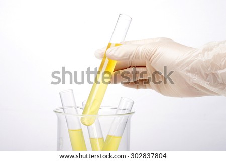 A woman(nurse, scientist) hand with (rubber) glove storage hold a test tube with yellow(urine) liquid(fluid) and beaker for chemical, health, urology at the laboratory