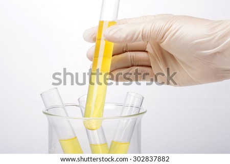 A woman(nurse, scientist) hand with (rubber) glove storage hold a test tube with yellow(urine) liquid(fluid) and beaker for chemical, health, urology at the laboratory