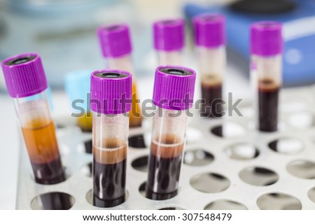 Blood Collection Tube diagnostic Test