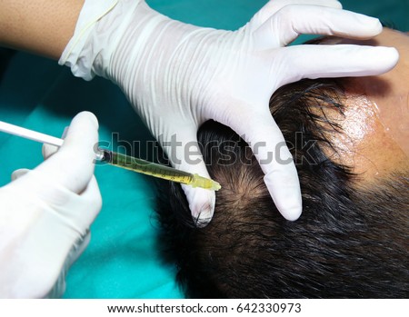 medical treatment of hair loss,stimulating injection for Hair growth