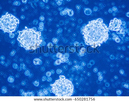 Glioblastoma stem cells organized in tumor niche formation