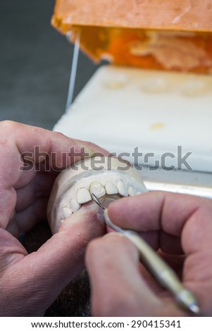 Dental laboratory, manufacturing dental prostheses