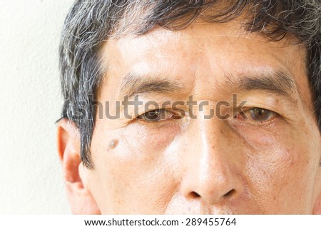 Closeup asian old man face on white background. His eyes are Pinguecula.
