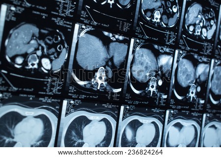 research in medicine. CT scan of the patient.