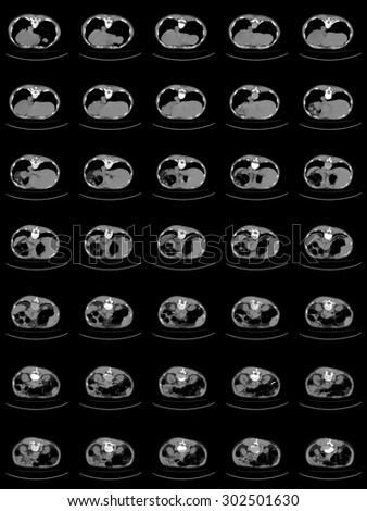 computer tomography of chest and abdomen, ct scan isolated on black background.