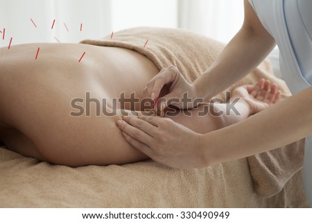 Patients undergoing acupuncture on the body in the salon