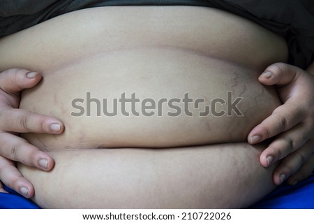 Fat people fat