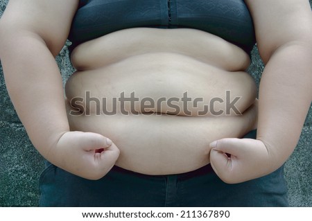 Fat people are fat