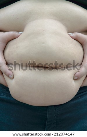 Fat people stomach