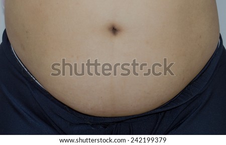 Fat belly fat people