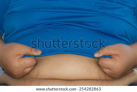 Obese people with belly fat