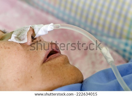 feeding tube for unidentified old woman at the hospital