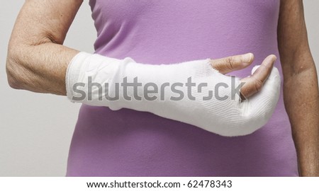 Closeup of senior woman\'s arm in a bandage and cast.
